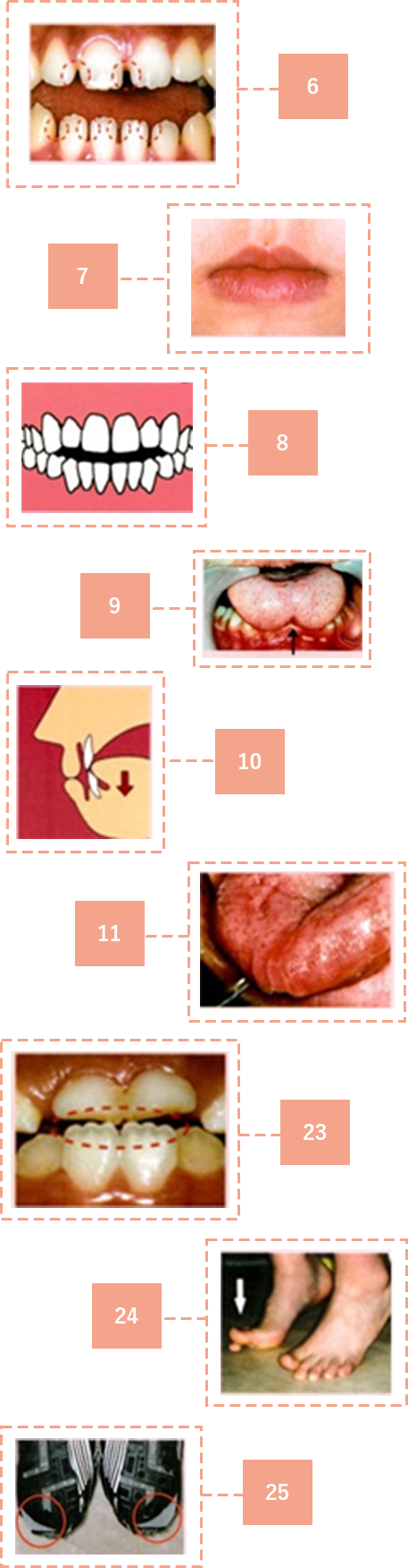 セルフチェック